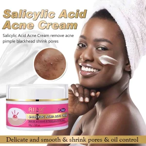 Organic Acne Face Cream,